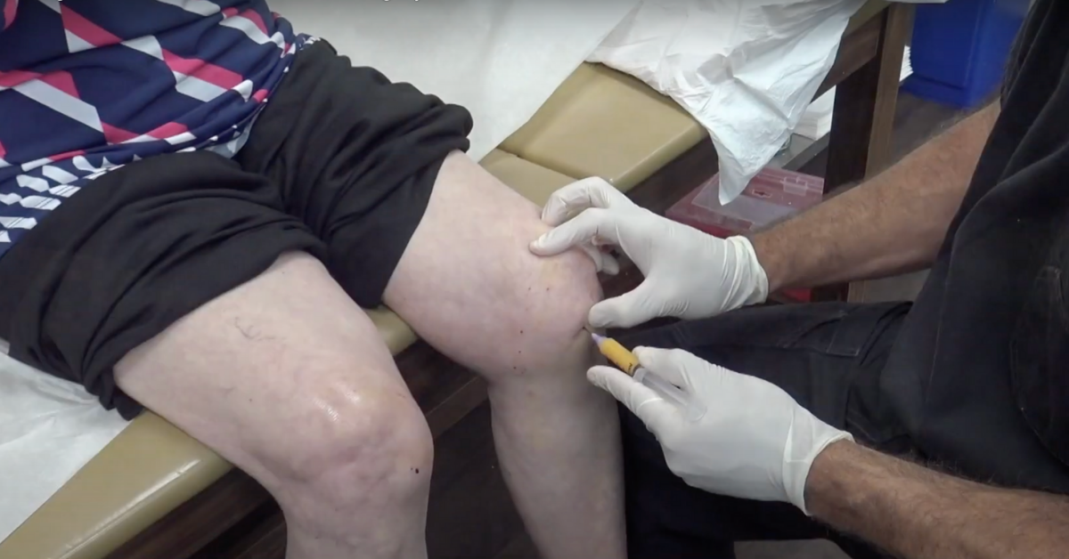 Stem Cell Therapy Process